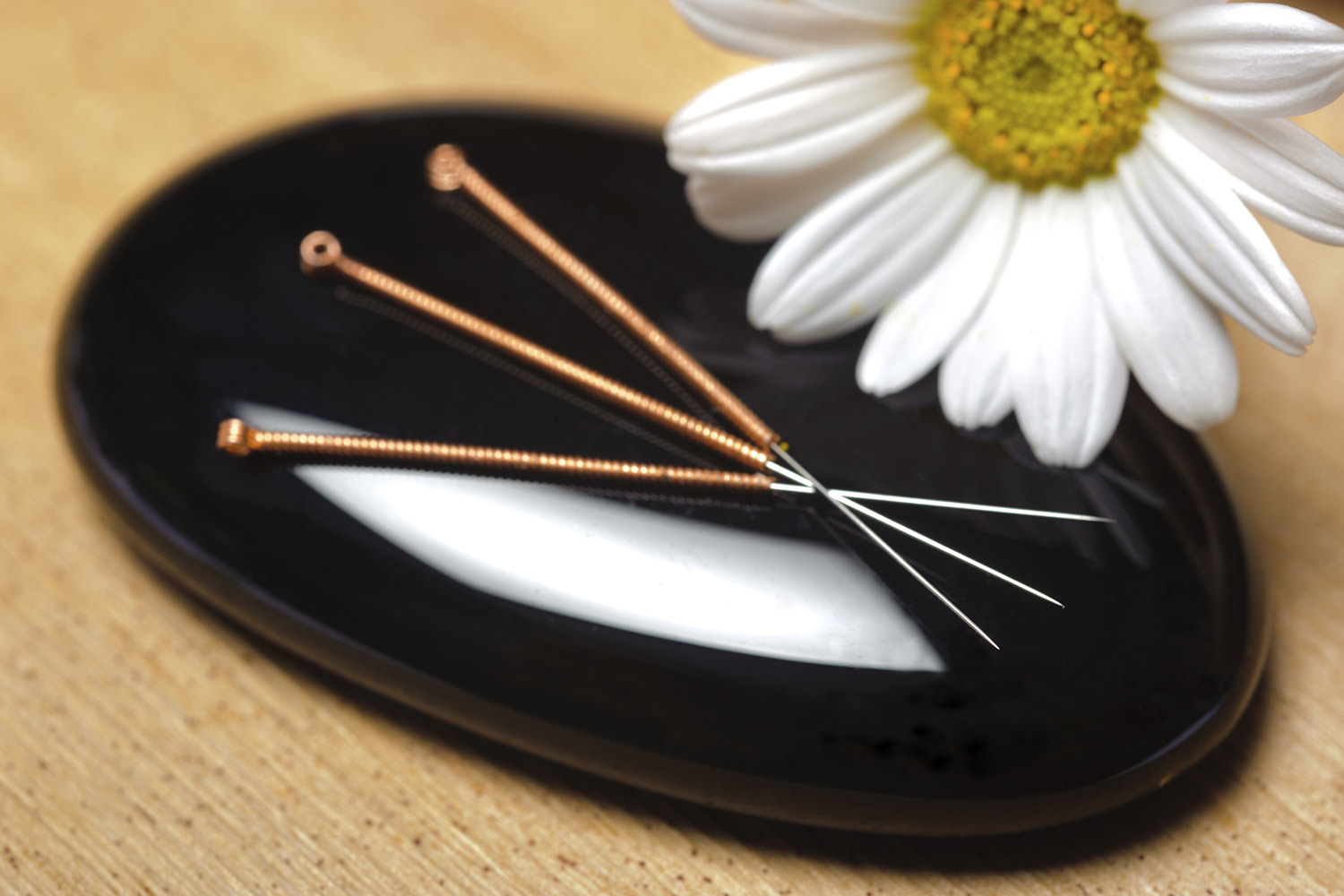 acupuncture treatment in Emsworth